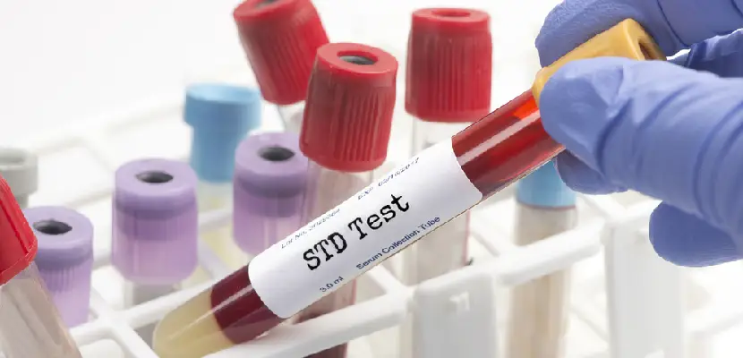 Transmitting a Sexually Transmitted Disease (STD) is a Crime in N.J.